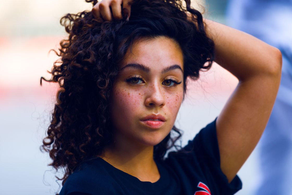 acne scars